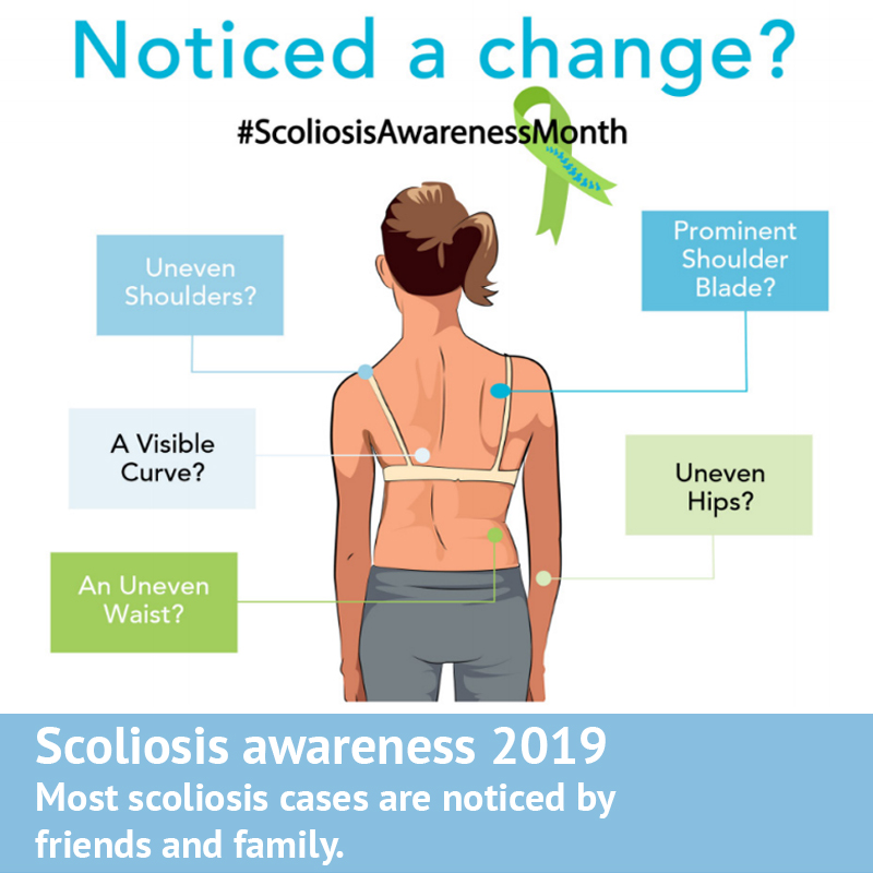 A Scoliosis Journey: Week 1 - Scoliosis Clinic UK - Treating