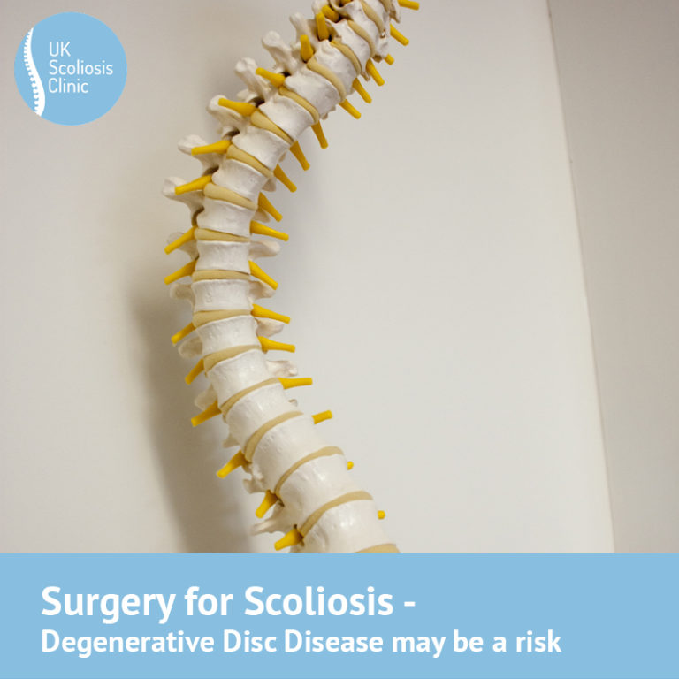 Degenerative Disc Disease Archives Scoliosis Clinic Uk Treating Scoliosis Without Surgery 0887