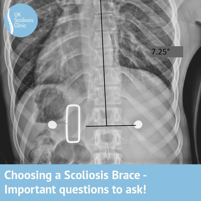 How to choose a scoliosis brace – questions to ask your practitioner -  Scoliosis Clinic UK - Treating Scoliosis without surgery