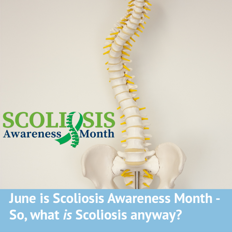 Scoliosis Awareness Month Archives - Scoliosis Clinic UK - Treating ...