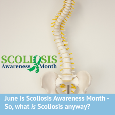 Scoliosis Clinic Uk – Treating Scoliosis Without Surgery