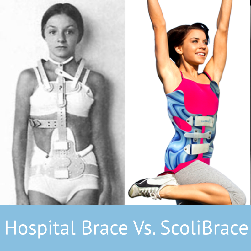 a)TLSO-type brace with low pads that cause poor correction, b)a