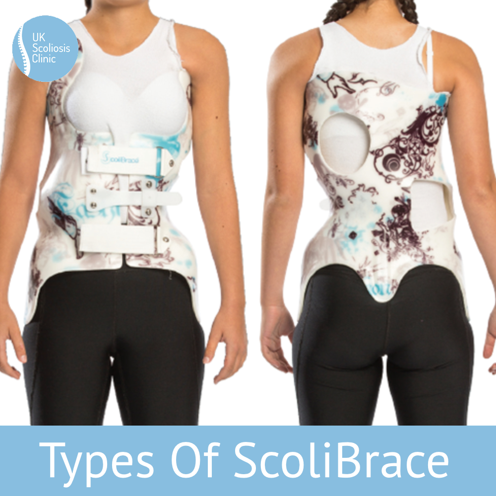 Lumbar (A), Thoracolumbar (B) and Thoracic (C) Boston Brace.