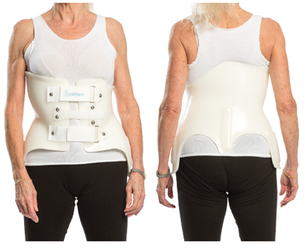 Scoliosis Brace Types: Which is Best for Me?