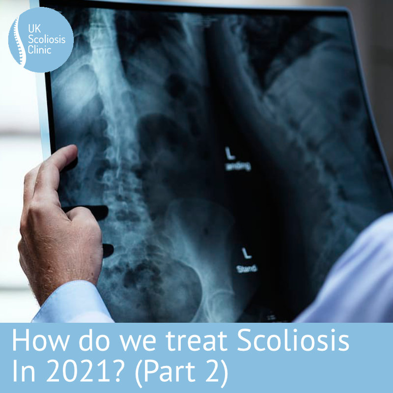 SEAS Archives - Scoliosis Clinic UK - Treating Scoliosis without surgery