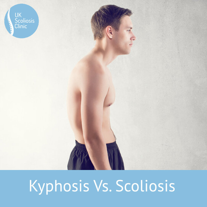 Kyphoscoliosis Causes Symptoms And Treatment