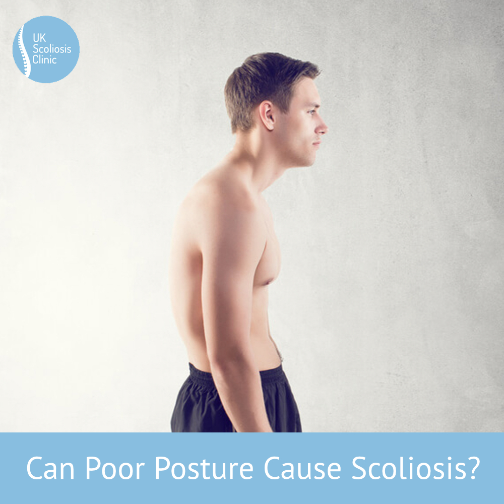 scoliosis treatment Archives - Scoliosis Clinic UK - Treating Scoliosis  without surgery